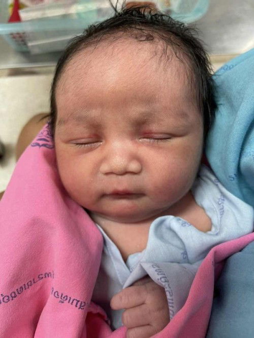 มารายงานตัวจ้า ผ่าคลอด37Week เพศหญิงน.น.3,045จ้า