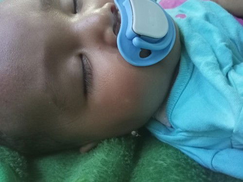 bintik putih di wajag