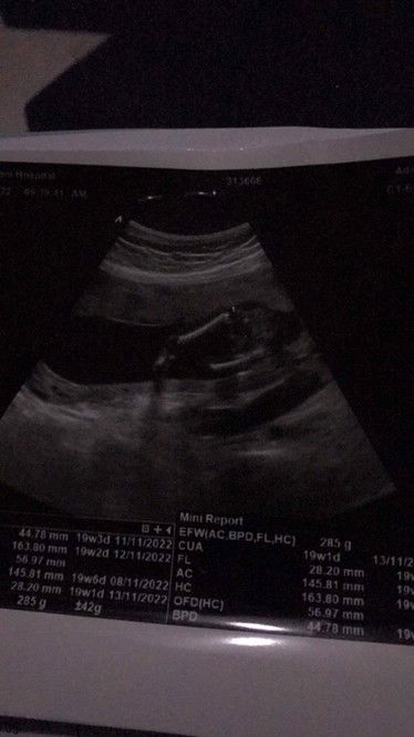 แบบนี้น้องผู้หญิงรึผู้ชายค่ะ