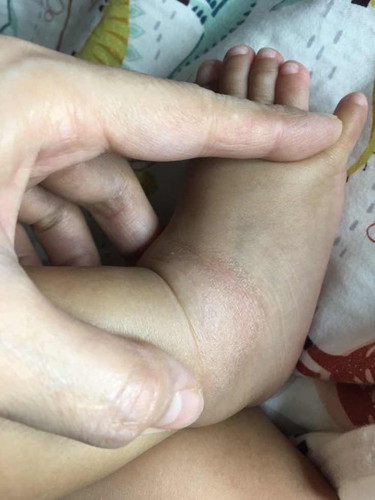 Skin problem