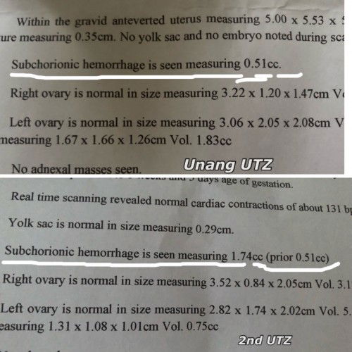 SUBCHORIONIC hemorrhage #PLEASEHELP