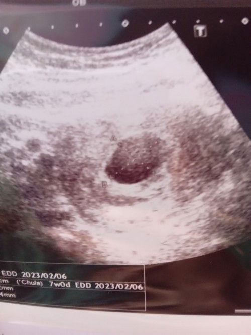 ขอความเห็นของแม่ๆด้วยน้ะคะ🙏