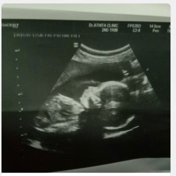 อดีตกับปัจจุบัน