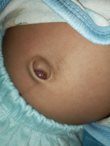 Cara agar pusar bayi cpt kering