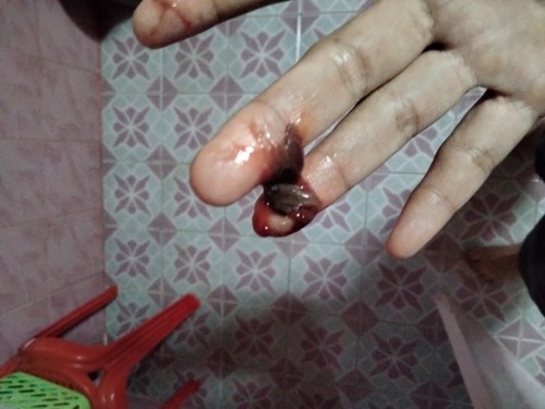 Kandungan sye berusia 7 minggu 2 hari sye berjln terlalu bnyk dan klur darah doctor kata luka bhya x