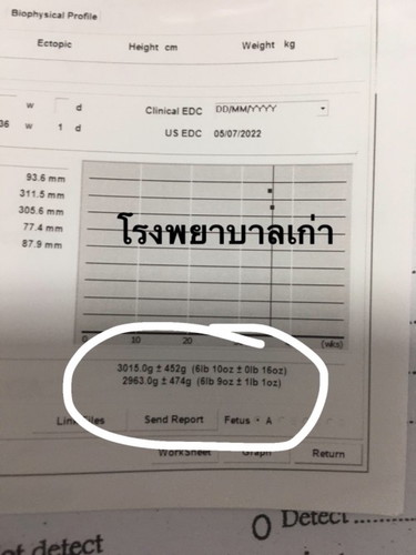 นํ้าหนักลูกเปลี่ยน