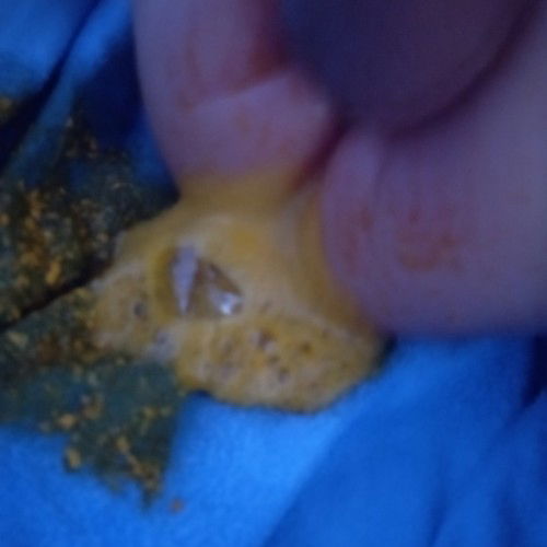 #ช่วยบอกหน่อยค่ะ
ลูกอึแบบนี้ใช่ท้องเสียไหมคะเวลาจะอึชอบแบ่งและร้อง