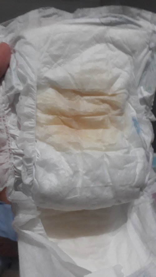 Urine bayi