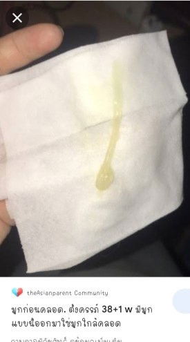 มีมูกใสๆไหลผิดปกติหรือเปล่า?