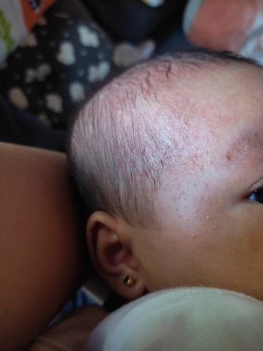 Rashes po ba ito or ano?