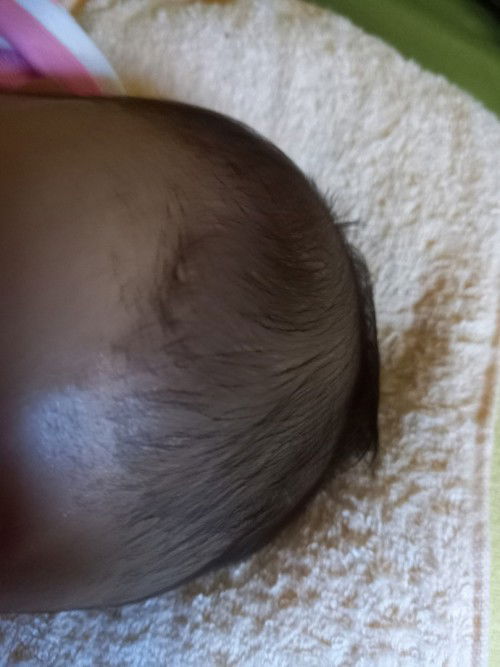 Ubun-ubun bayi mbut-mbut