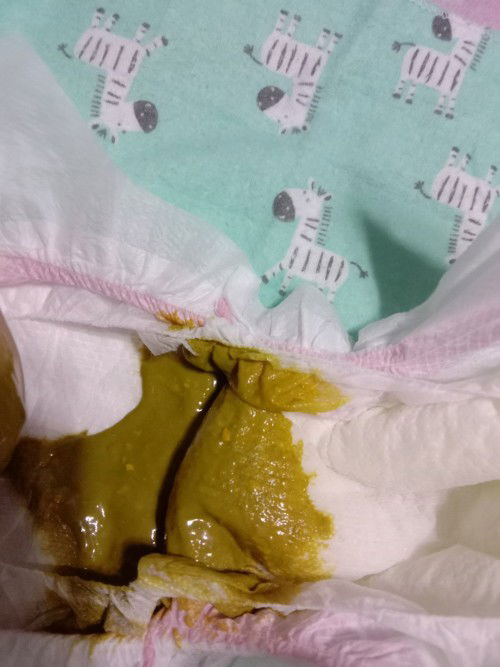 Ask lang po about poop ni lo kung normal lang po ba to