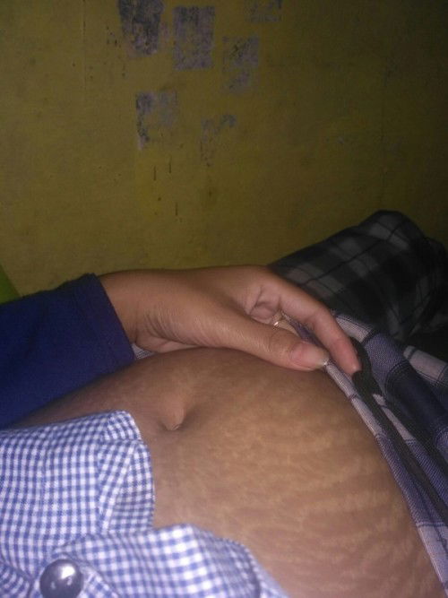 Mengurangi strechmark