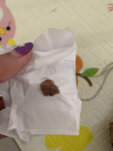 ภาวะแท้งคุกคาม