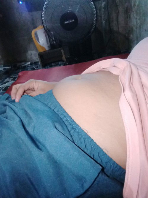 Hello po .puson ba talaga lumalaki .. mag 2months nayan ngayun june 25  respect post