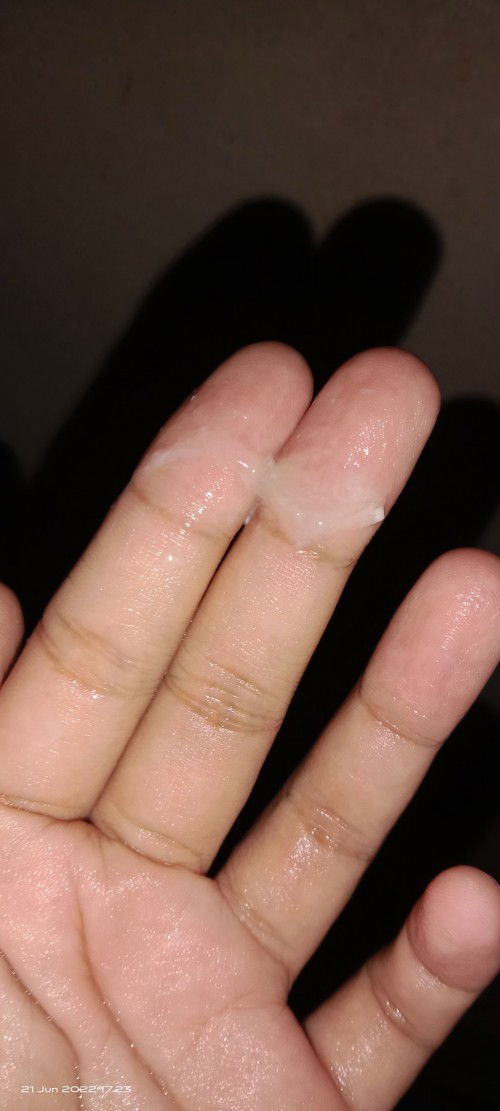 Lendir di kehamilan 35 minggu