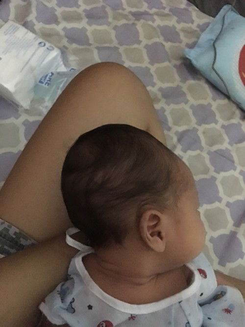 ลูกศีรษะเป็นลักษณะนี้แบบนี้เรียกว่าผิดปกติรึป่าวคะ กังวล