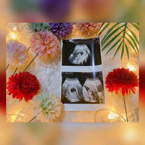 Perjuangan 5 Tahun 😍 Hpht 02022022 & HPL November 2022 ❤️