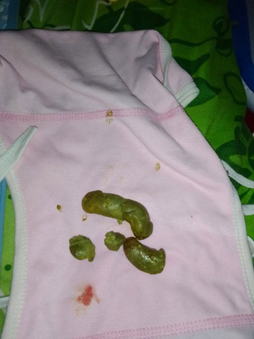 Bab keras dan berdarah