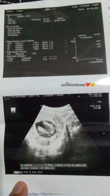 ช่วยดูหน่อยค่ะว่าเพศอะไรคะ