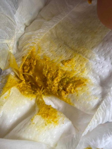 ลูกมีอาการถ่ายอุจจาระมีมูกใสปน