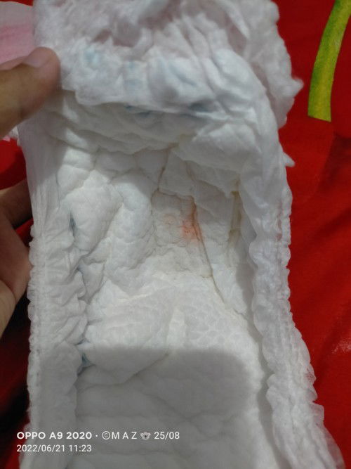 Warna urine seperti darah