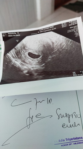 Bunda ada yg pernah ngalamin nggak .. kehamilan 7minggu ..janin masih terlihat samar