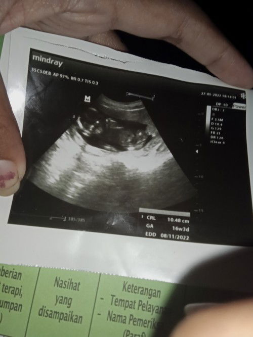 Berat janin yang mana ya bunda