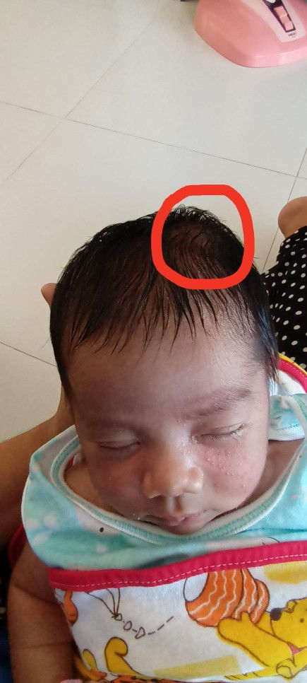 น้องที่คลอดเองแบบธรรมชาติบ้านไหน มีรอยบวมที่ศรีษะบ้างคะ 
บวมแบบนิ่มๆอ่ะค่ะ บ้านนี้บวมตรงหัวโหนกค่ะ