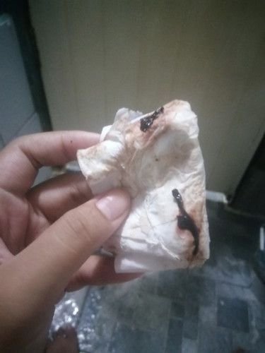 มีเลือดออก