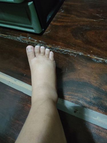 34+4 week