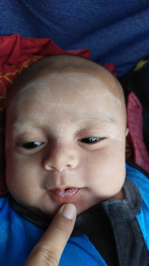 Mulut dan lidah putih minum sufor