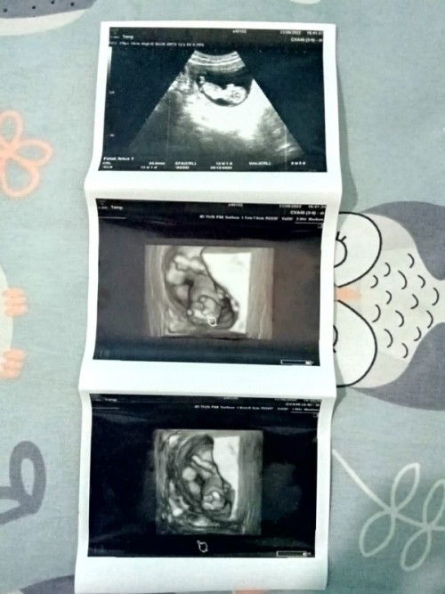 Bun usia brpa bisa diketahui jenis kelamin?