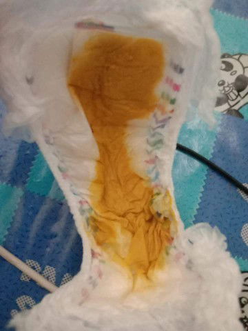 อึสีแบบนี้