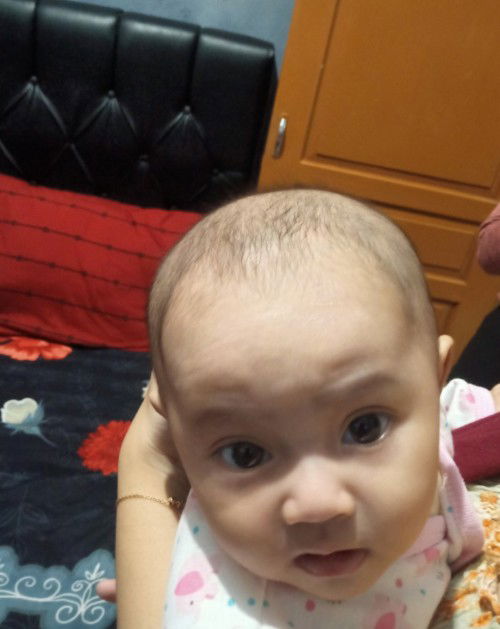 Kepala Berbentuk Bando