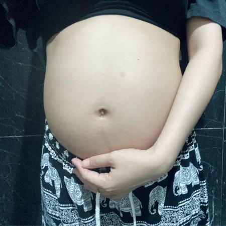 แม่แม่ 
 - น้องได้ 18 w แล้วแต่รู้ว่าท้องโตมาก