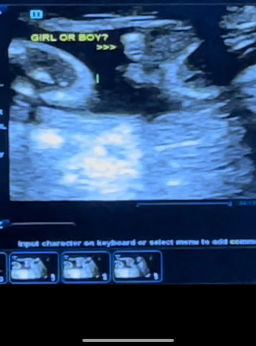 Ano kaya gender? Girl or Boy?