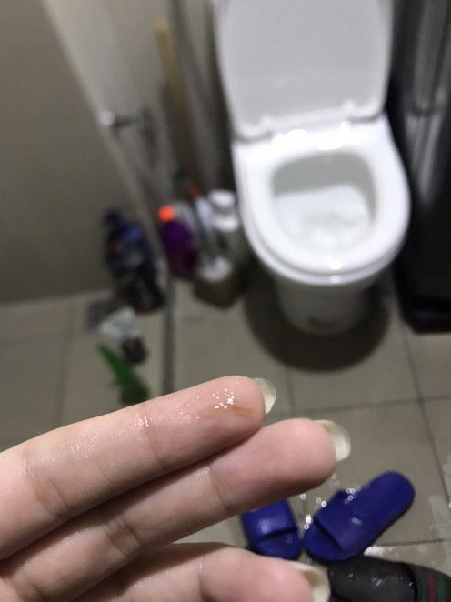 normal lang poba to may lumabas sakin ganito 7 weeks pregant here