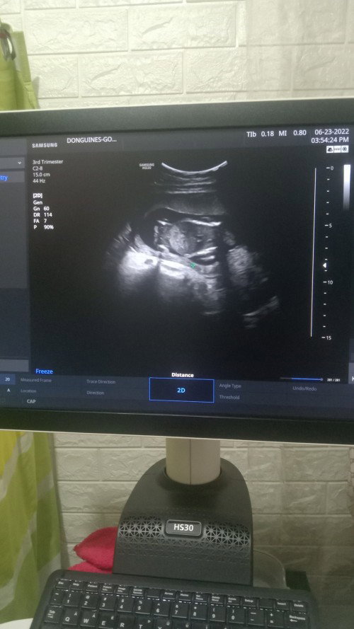Pwde na po ba malaman kung anong kasarian ni baby Hinde Po kc nasabi Ng obygne.  I'm 17weeks preg.