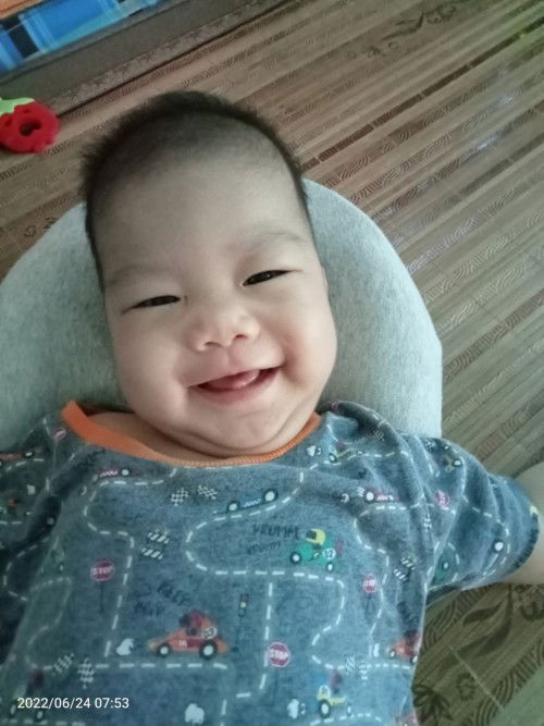 E bé nhà mình hơn 7tháng bé ngủ rất ít chỉ 5.10phut dây lần tóc thì ngày một rụng thưa tóc 😇