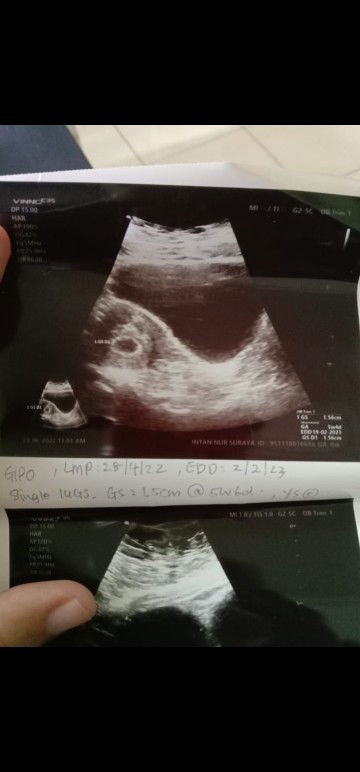 Prgnant 8week tapi kantung baru 5week