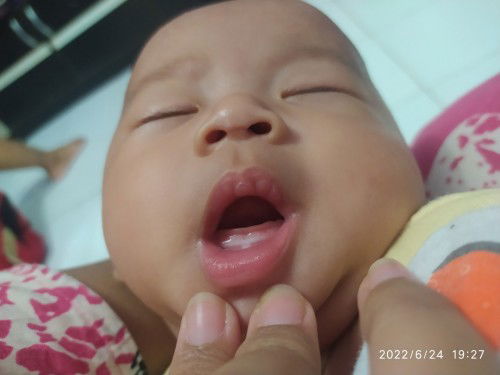 Gigi atau bukan ya bun?