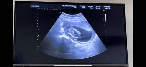 ชายหรือหญิง ขอสอบถามแม่ๆหน่อยค่ะ