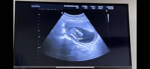 ชายหรือหญิง ขอสอบถามแม่ๆหน่อยค่ะ