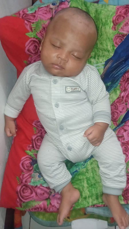 Warna kulit wajah tidak merata