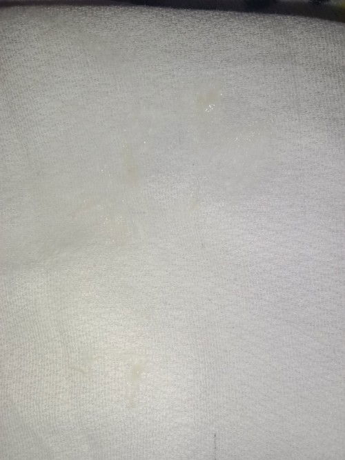 Pag nag burp Minsan may kasamang plema