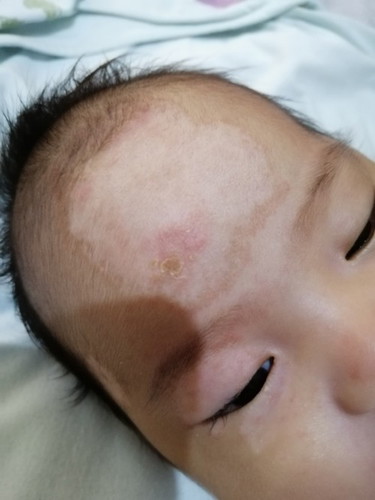 Sana may makatulong po, ano po kaya pwedeng I gamot po sa baby ko . Pls any suggestions naman po Ty.