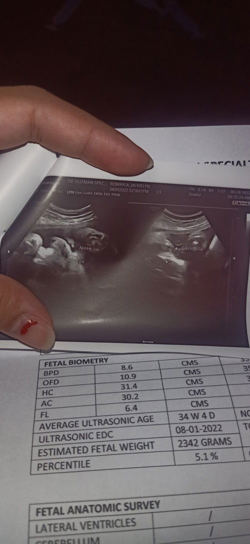 Pa help mga mi paano kopo mapapataas ng konti weight ni baby 2342g palang sya 37 weeks na ako buks🥺