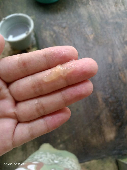 Keluar lendir seperti ingus