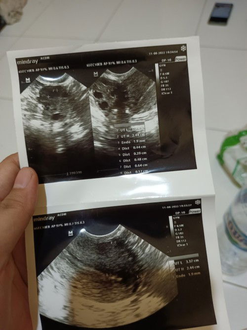 Mau tanya² dong bunda yang udh pada pengalaman